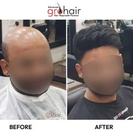 hair treatment before and after