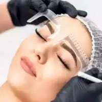 eyebrow transplant